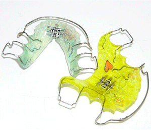 Детские ортодонтические пластинки